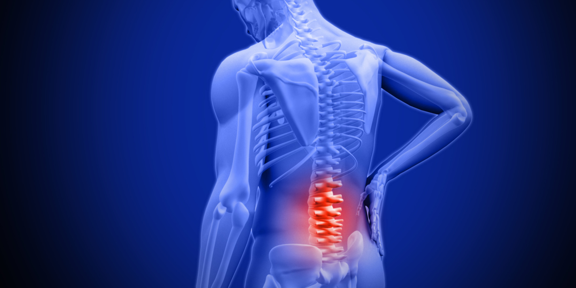 Low back pain - The Lancet
